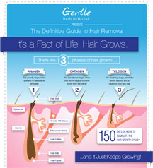 laser hair removal infographic